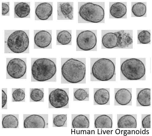 Organoid Batch Analysis